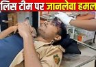 पटेवा में शराब तस्करों को पकड़ने गई पुलिस टीम पर लाठी-डण्डा और ईट-पत्थर से हमला, TI समेत कई पुलिसकर्मी गंभीर, महिला आरक्षक घायल