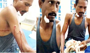 खेत में काम कर रहे ग्रामीण पर तेंदुए का हमला, गंभीर घायल, सूझबूझ से बची जान,  पाण्डुका वन क्षेत्र में दहशत, वन विभाग की कार्यप्रणाली पर सवाल