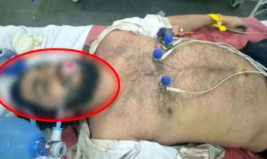 बारिश में अनियंत्रित होकर पेड़ से टकराई GT 650 बाइक, CMD कॉलेज के छात्र की इलाज के दौरान मौत, इलाके में पसरा मातम, जांच में जुटी पुलिस