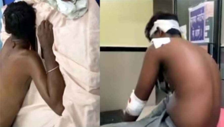मामूली विवाद ने लिया हिंसक रूप, ज्यादा गुपचुप खिलाने को लेकर नाराज ग्राहक ने  पिता-पुत्र पर चाकू से किया जानलेवा हमला, जांच में जुटी पुलिस