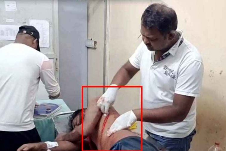 कॉलोनी के सामने कटरबाजी, 5 लोगों ने पैसों के विवाद को लेकर युवक को घेरकर चलाया कटर, इलाज जारी, बदमाशों की तलाश में जुटी पुलिस