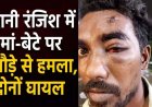 रायपुर में मां-बेटे पर हथौड़े से हमला, मचा हड़कंप, पुरानी रंजिश में आरोपी ने की वारदात, हमले में मां और बेटा दोनों घायल, मामला दर्ज, जांच में जुटी पुलिस