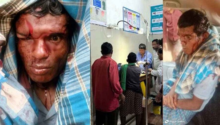 गरियाबंद में भालू का हमला: शौच के लिए गए ग्रामीण गंभीर घायल, आंखों के ऊपर पंजे और नाखून से गहरे जख्म, रेंजर सुशील सागर ने पहुंचाया हॉस्पिटल