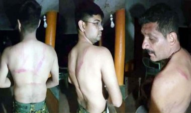 देर रात जमकर बवाल : गश्त पर निकले रेंजर-डिप्टी रेंजर को पांच घंटे बनाया बंधक, खूब पिटाई कर पर्स-मोबाइल भी छीना, जांच में जुटी पुलिस