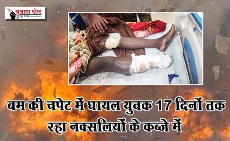 CG News : बम की चपेट में घायल युवक 17 दिनों तक रहा नक्सलियों के कब्जे में