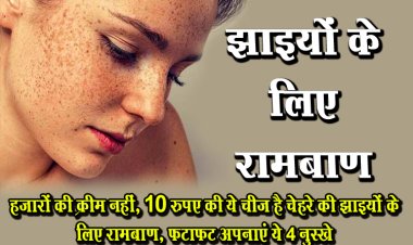 हजारों की क्रीम नहीं, 10 रुपए की ये चीज है चेहरे की झाइयों के ल‍िए रामबाण, फटाफट अपनाएं ये 4 नुस्‍खे