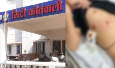 राजधानी में थम नहीं रही चाकूबाजी की घटनाएं, अज्ञात बदमाशों ने CA स्टूडेंट पर किया जानलेवा हमला, पुलिस कर रही मामले की जांच