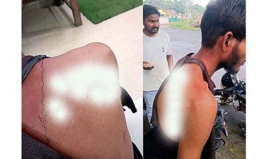 सतनामी समाज अध्यक्ष के बेटे के ऊपर हुआ जानलेवा हमला, चाकूबाजी करने वालों को आखिरकार किसका संरक्षण?