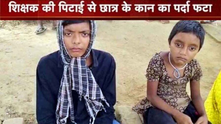 छत्तीसगढ़ की सरकारी स्कूल के शिक्षक की बर्बरता, टीचर चक्रधारी सिंह के चांटा मारने से छात्र के कान का पर्दा फटा