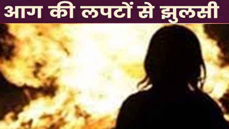 आग में झुलसी नाबालिग लड़की, खाना बनाते वक्त हुआ हादसा, आनन फानन में जिला अस्पताल में इलाज के लिए कराया गया भर्ती