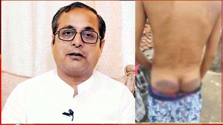 डायल 112 के जवान ने बेरहमी से की खौफनाक पिटाई, इंसाफ के लिए पीड़ित युवक पहुंचा SP ऑफिस, पुलिस का अमानवीय चेहरा शैलेश पाण्डेय