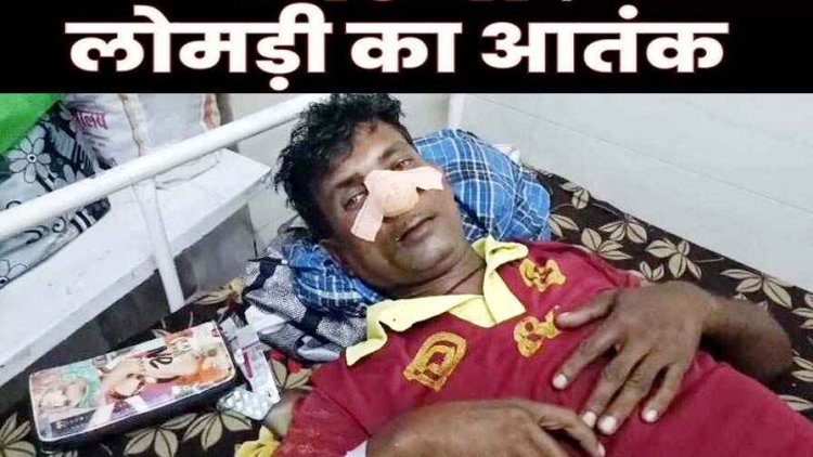 लोमड़ी का आतंक, खाने के बाद टहलने गए युवक पर लोमड़ी ने किया हमला, नाक पर 13 टांके, लोगों में दहशत का माहौल, अब तक 17 लोग घायल