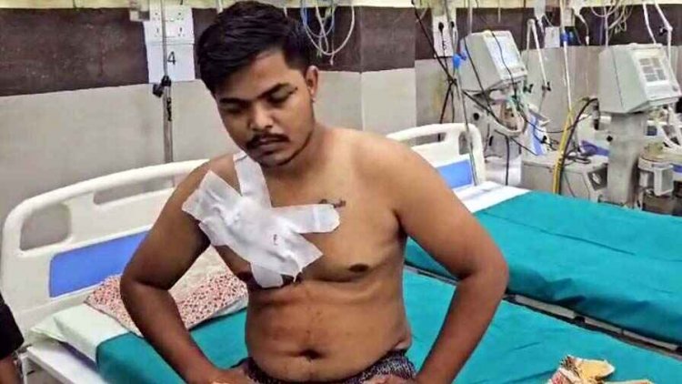 मां-बेटे के बीच हुआ विवाद, बेरोजगार युवक ने खुद को चाकू मारकर किया खुदकुशी की कोशिश, बदहवास मां ने हॉस्पिटल पहुंचाकर बचाई बेटे की जान