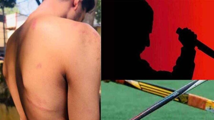 सहायक आरक्षक पर चाकू से वार, पिता से हुआ विवाद, 12वीं की छात्रा को रोककर की पिटाई, बाइक देने से इंकार पर जानलेवा पर हमला