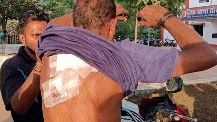 नाबालिग बनते जा रहे चाकूबाज, लड़की से छेड़छाड़ करने से मना करने पर दिनदहाड़े विष्णु पर किया ताबड़तोड़ चाकू से वार, भाई से मारपीट