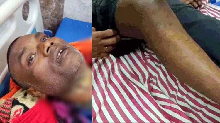 सूरजपुर में जमीन विवाद को लेकर पत्नी और बहन-बहनोई ने पति को 10 दिनों तक बनाया बंधक, हथौड़ी मारकर तोड़ा हाथ-पैर, पिला दिया एसिड