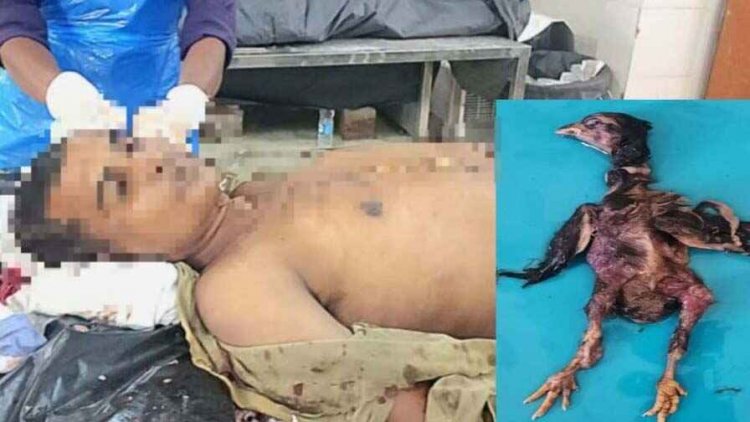 अंधविश्वास से जुड़ी दुखद घटना, जिंदा मुर्गे को निगलने की कोशिश में गले में फसने से युवक और मुर्गा दोनों की हुई मौत, जांच में जुटी पुलिस