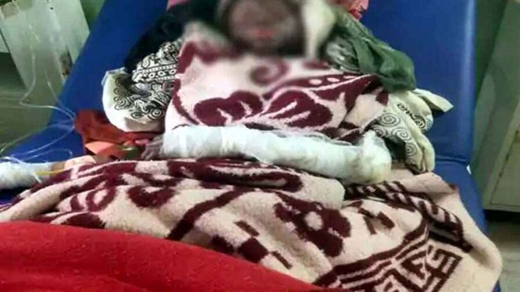 दुकान में अवैध रिफिलिंग के दौरान फटा गैस सिलेंडर, बुरी तरह झुलसा नाबालिग, अस्पताल में भर्ती, हालत नाजुक, आरोपी फरार, जांच में जुटी पुलिस