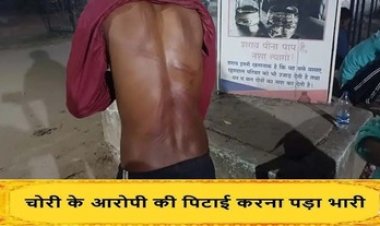 चोरी की नीयत से घुसे दो नाबालिग बच्चों की बेरहमी से पिटाई, अस्पताल में भर्ती, प्लांट के कर्मचारी और गार्ड के खिलाफ मामला दर्ज, जांच में जुटी पुलिस