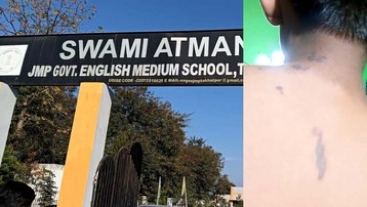 स्वामी आत्मानंद स्कूल में 11वीं के छात्र पर एसिड से हमला, स्टूडेंट को किया गया रेस्टीगेट, टीचर को दिया सावधानी बरतने का निर्देश, होगी जांच