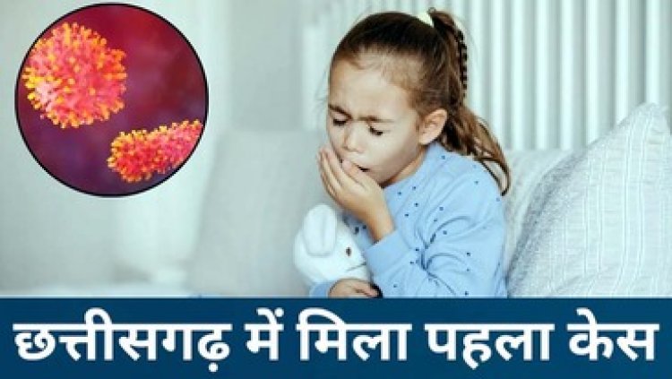 छत्तीसगढ़ में तीन साल का बच्चा मिला पॉजिटिव, खतरनाक वायरस का पहला मामला, सेहत में नहीं हो रहा सुधार, मचा हड़कंप, जिले में अलर्ट जारी