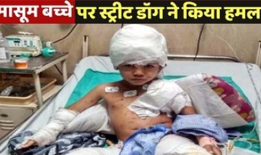 राजधानी में डॉग बाइट की दर्दनाक घटना, 10 मिनट तक छह साल के मासूम को नोचते रहे तीन आवारा कुत्ते, खोपड़ी खुल गई, शरीर में 200 से ज्‍यादा छेद
