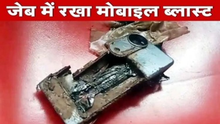 पैंट की जेब में मोबाइल लेकर घूम रहा था युवक, अचानक हुआ जोरदार ब्लास्ट, पैर झुलसा, इलाज के लिए अस्पताल में भर्ती