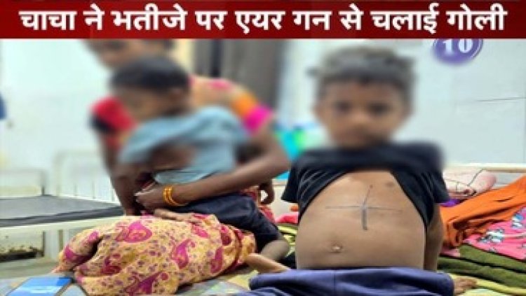 चाचा ने 4 साल के मासूम भतीजे पर एयरगन से किया फायरिंग, डॉक्टरों ने ऑपरेशन कर निकाली पेट में फंसी गोली, आरोपी बिसेश्वर गिरफ्तार