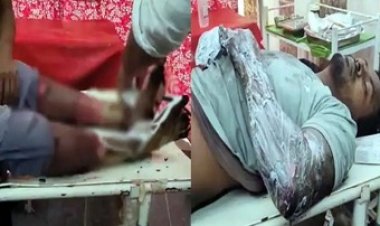 मालगाड़ी से कोयला चोरी करते समय हाईवोल्टेज तार की चपेट में आया युवक, हाथ और पैर झुलसे, अस्पताल में भर्ती, हालत नाजुक