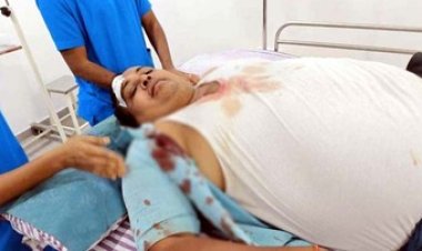 आपतिजनक हालत में युवक-युवती को देखकर डॉक्टर ने दी समझाइश, डॉ. पर किया जानलेवा हमला, आरोपी मोहन गिरफ्तार, युवती मौके से फरार