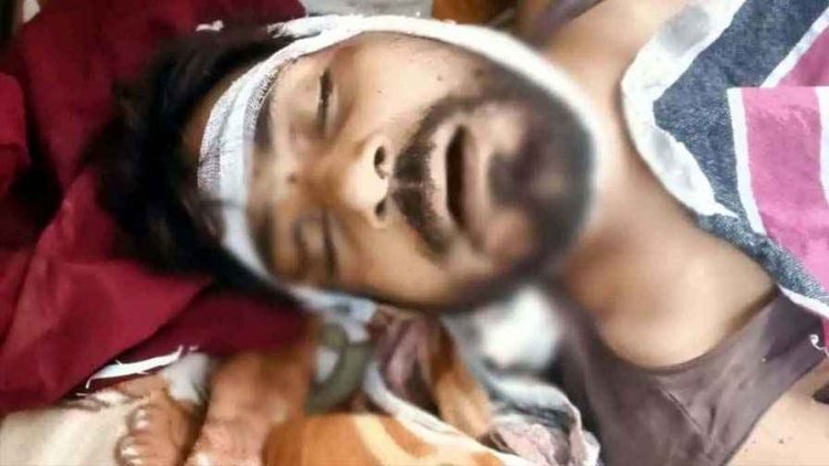 जमीनी विवाद को लेकर लाठी-डंडा और सब्बल से शराब के नशे में जानलेवा हमला, एक युवक की मौत, गर्भवती महिला समेत कई घायल, हिरासत में 3 आरोपी