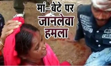 मां-बेटे पर लाठी से हमला: छेना थापने के लिए भूसे को लेकर हुआ विवाद दोनो गंभीर रुप से हुए घायल, मामूली विवाद बना हिंसक, सिम्स रेफर
