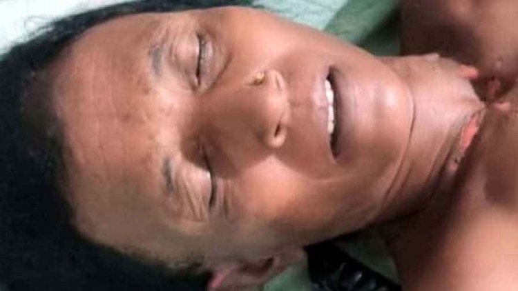 बादल फटने और बिजली गिरने से खेत में निदाई करने गई महिला की मौत, बाकी घायलों का इलाज मेडिकल कॉलेज सेंटर में जारी