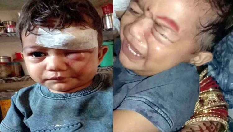 मवेशियों की लड़ाई से मचा हड़कंप, गणेश-पंडाल के पास खड़े बच्चे समेत 4 लोग घायल, मासूम का दांत टूटा, आंख के पास आई चोट