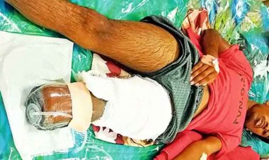 अंधविश्वास का खौफनाक अंजाम, सांप के डसने पर झाड़-फूंक के चक्कर में छात्र ने गंवाया पैर, क्रांतिकारी विचार मंच ने उठाई सख्त कार्रवाई की मांग