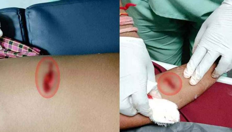 रायपुर में शराब के लिए पैसे न देने पर नाबालिग ने किया मां-बेटे पर चाकू से हमला, दोनों गंभीर रूप से घायल, आरोपी फरार, तलाश जारी