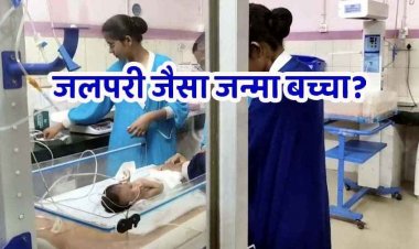 धमतरी में जन्मा जलपरी शिशु, कुदरत का करिश्मा देखकर दंग रह गए डॉक्टर और परिजन, निचला हिस्सा आपस में जुड़ा हुआ और सिर्फ एक ही पैर