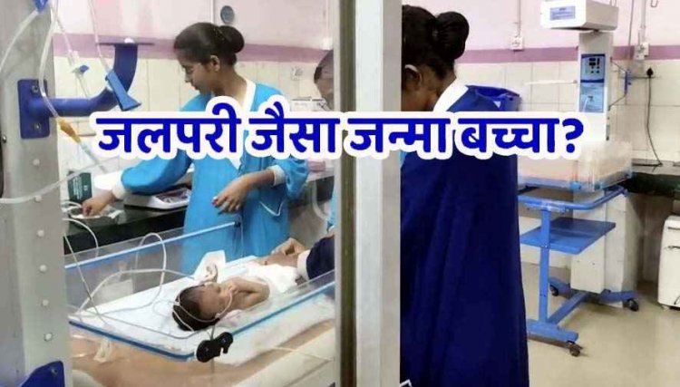 धमतरी में जन्मा जलपरी शिशु, कुदरत का करिश्मा देखकर दंग रह गए डॉक्टर और परिजन, निचला हिस्सा आपस में जुड़ा हुआ और सिर्फ एक ही पैर
