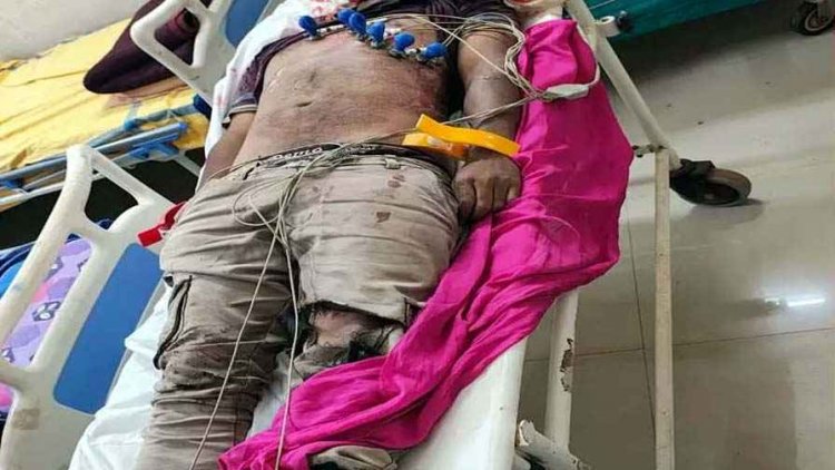 रायपुर में दिवाली से पहले हिट एंड रन, तेज रफ्तार कार ने बाइक को पीछे से मारी जोरदार टक्कर, दर्दनाक हादसे में 3 लोगों की मौत, चालक गिरफ्तार