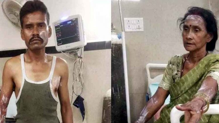 देर रात मंदिर खोलने को लेकर विवाद, आरोपी ने मां-बेटे पर फेंका उबलता तेल, दोनों गंभीर रूप से झुलसे, इलाज जारी, इलाके में तनाव का माहौल