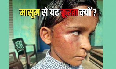 गिनती न सुना पाने पर शिक्षक का अत्याचार, दूसरी कक्षा के मासूम छात्र की आंख में उतरा खून, ग्रामीणों में आक्रोश, टीचर सस्पेंड, FIR दर्ज