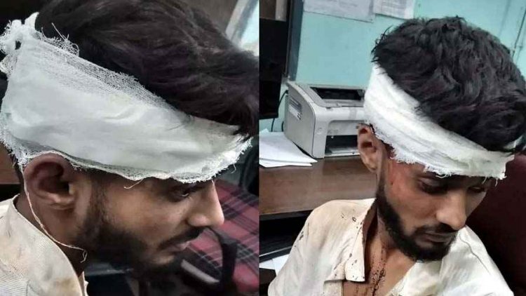 बीबीए के छात्र से दोस्तों ने बेरहमी से की सामूहिक मारपीट, 5 युवकों पर FIR दर्ज, छात्रों में दहशत का माहौल, जांच में जुटी पुलिस
