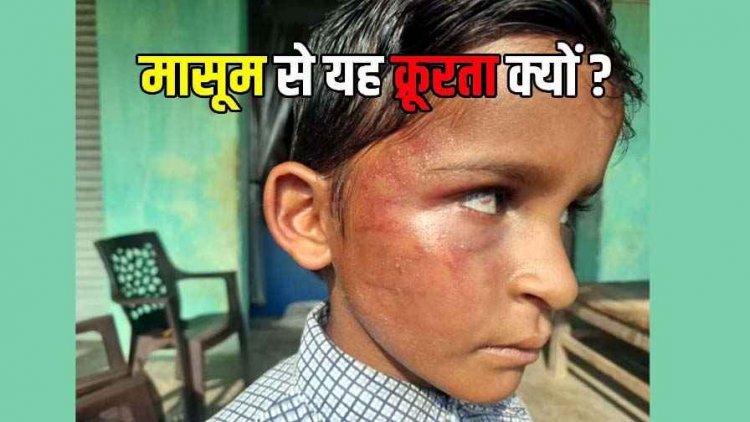 गिनती न सुना पाने पर शिक्षक का अत्याचार, दूसरी कक्षा के मासूम छात्र की आंख में उतरा खून, ग्रामीणों में आक्रोश, टीचर सस्पेंड, FIR दर्ज