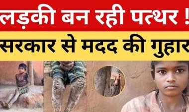 14 वर्षीय आदिवासी लड़की का शरीर धीरे-धीरे बन रहा पत्थर, खौफनाक बीमारी ने बदली मासूम की जिंदगी, त्वचा पर उग आई कांटेदार परत!