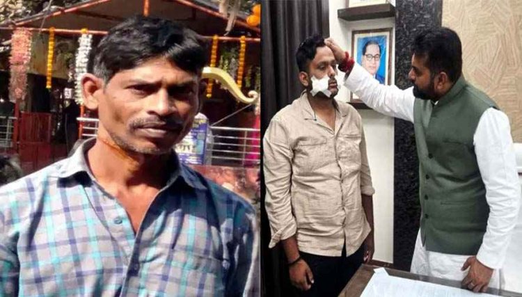 मकर संक्रांति पर चाइनीज मांझे से छात्र के गाल कटे, 34 टांके लगे, रायपुर में महिला का भी होंठ-अंगूठा कटा, भिलाई में मजदूर के गले पर चोट