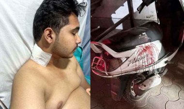 भेल खाने पहुंचे कांग्रेस नेता के बेटे पर चाकू से जानलेवा हमला, तीन युवक घायल, एक की हालत नाजुक, फैली सनसनी, सभी आरोपी फरार 