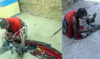 युवक ने खुद को आग लगाकर की खुदकुशी की कोशिश, इलाज जारी, पत्नी की नाराजगी और नशा बनी वजह?, पुलिस की तत्परता से बची जान