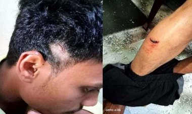 राजधानी में फिर चाकूबाजी, एक साल पुराने विवाद में युवक दोबारा भिड़े, पुलिस ने पीड़ित-आरोपी पर दर्ज किया केस, 2 आरोपी गिरफ्तार