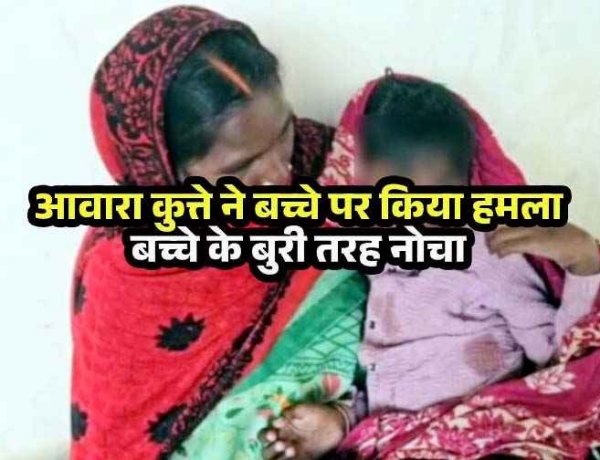 आवारा कुत्तों का बढ़ रहा आतंक, स्कूल जा रहे मासूम को कुत्ते ने बुरी तरह नोचा, नाजुक हालत में अस्पताल में भर्ती, इलाके में दहशत का माहौल