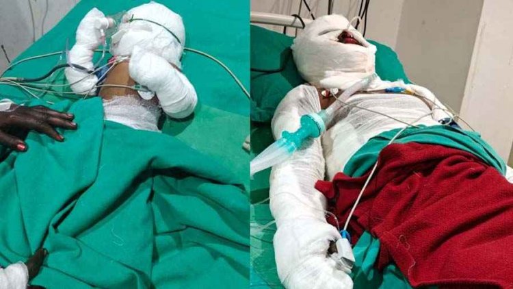 कार्बन प्लांट हादसे में 9 महीने की मासूम बच्ची की हुई मौत, घायल मजदूरों पर FIR वापस लेने का दबाव, परिजन कर रहे उचित मुआवजा की मांग